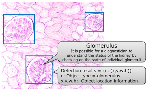 Figure 1: Kidney biopsy image and glomerulus detection
