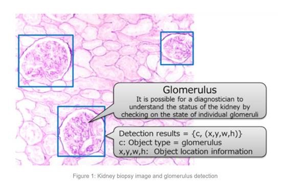 Glomerulus