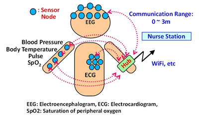 Figure 1: Schematic view of BAN System