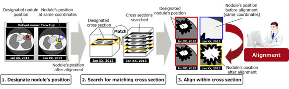 Figure 1: Observing changes in nodules over time by comparing images