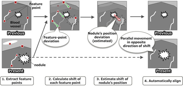 Figure 2: Basic approach for automatic alignment