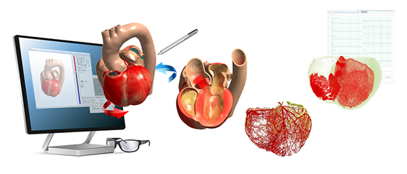 Figure: Stereoscopic view with a heart viewer