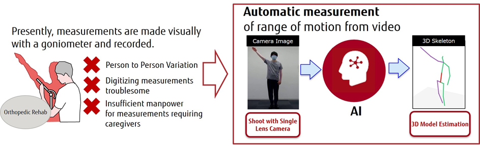 Fig. 1 Automatic detection of joint range of motion