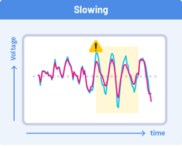 Fig. 2 EEG data of delirium state (blue line) and EEG data judged to be normal generated by this technology (red line)