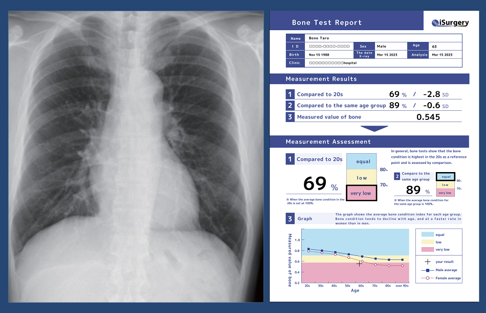 Image of analysis and inspection by AI medical device