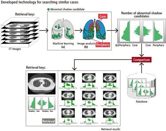 Developed technology for searching similar cases